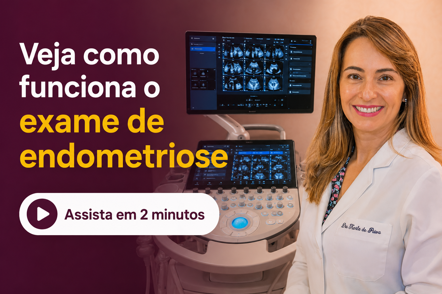Vídeo sobre o ultrassom para endometriose na Alvo